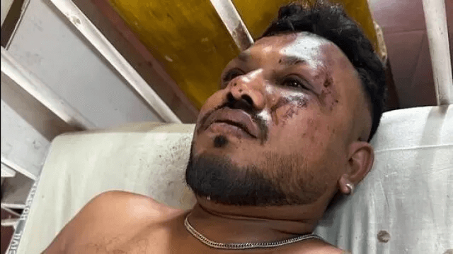 British‑Indian Man Survives Ahmedabad Air India Crash, Recounts Horror